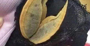 內(nèi)衣發(fā)霉怎么辦？霉博來士教你除霉措施！