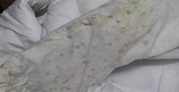 冬季服裝發霉,如何去霉防霉?