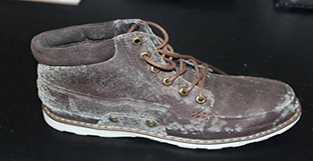 皮革霉菌種類你知道多少?