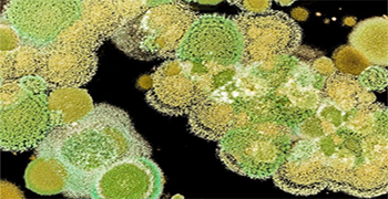 一定要知道的霉菌的危害!