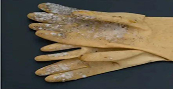 微生物災(zāi)害所涉及的領(lǐng)域有多少(三)?