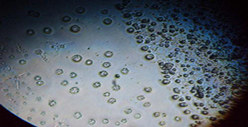 微生物活動與濕度的關系！