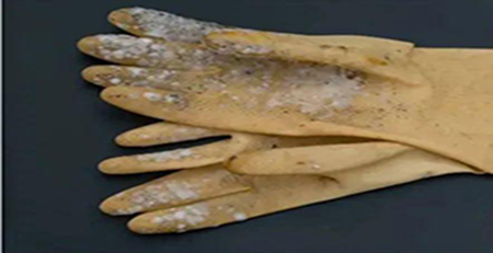 手套發(fā)霉