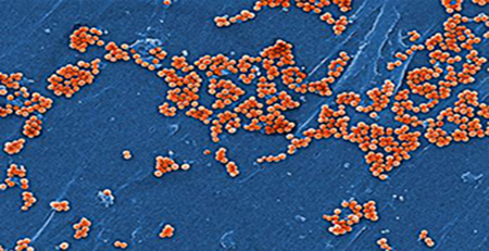 葡萄球菌毒素 葡萄球菌毒素